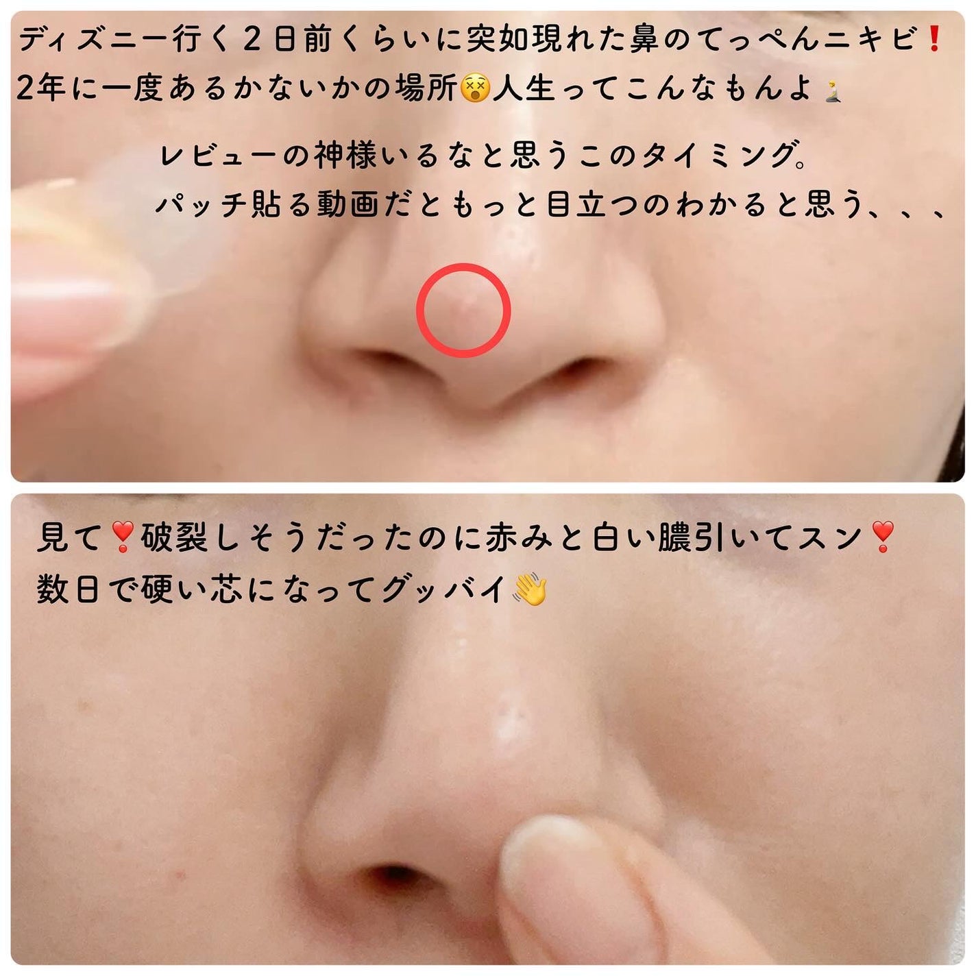 リリーのママ on LIPS 「💜DAEWOONG💜〈デウン製薬〉〜EasyDERM〜Easy..」(4枚目)