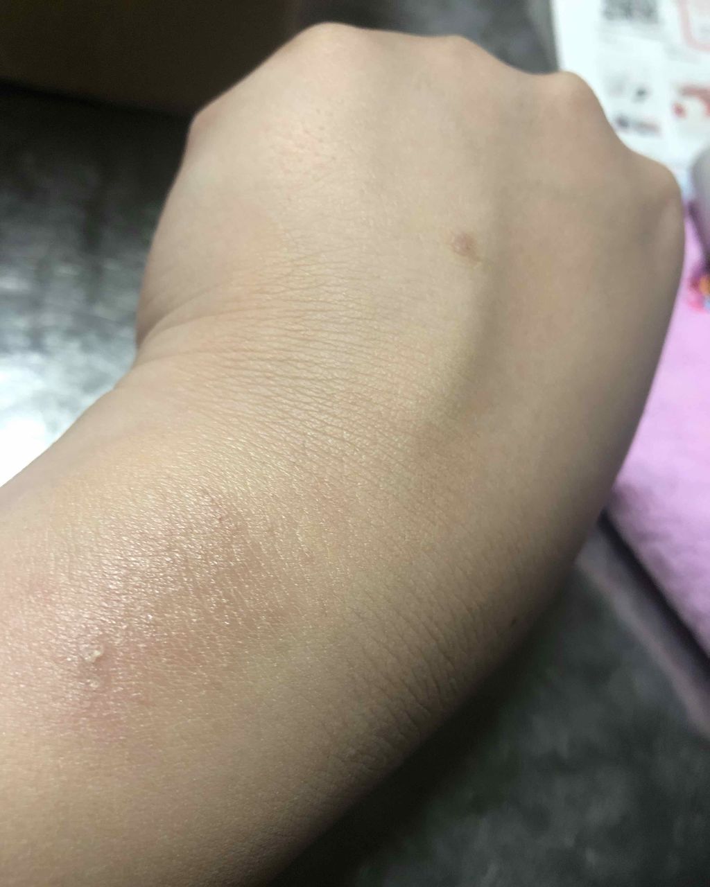 スキントリートメント ファンデーション/ナチュラグラッセ/リキッドファンデーションを使ったクチコミ(3枚目)