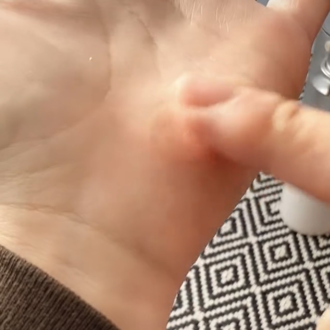 エッセンス/Homeo Beau/美容液を使ったクチコミ（3枚目）