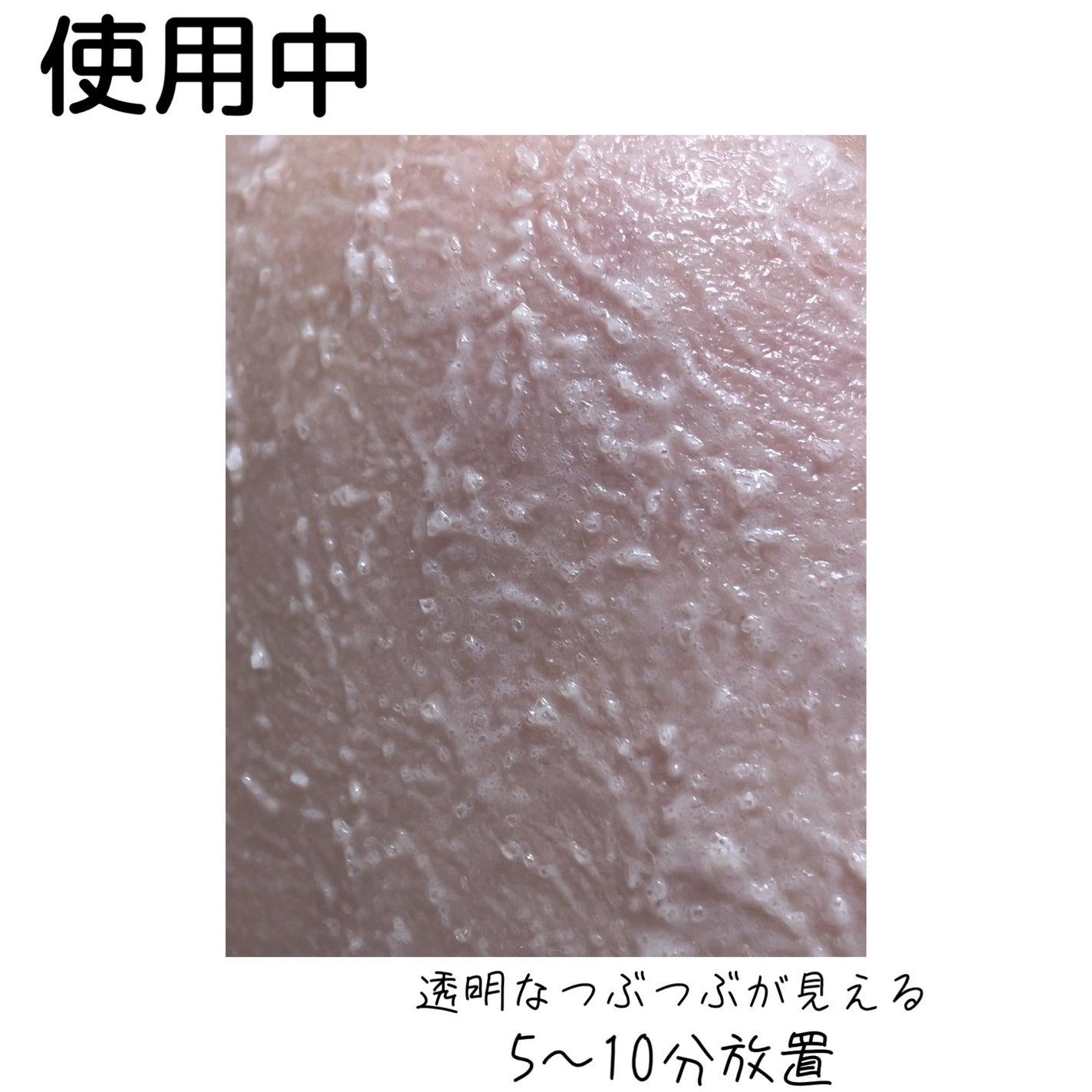 ピンクティーツリーライスシカウォッシュオフパック/APLIN/洗い流すパック・マスクを使ったクチコミ(4枚目)