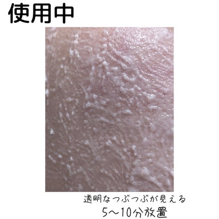 ピンクティーツリーライスシカウォッシュオフパック/APLIN/洗い流すパック・マスクを使ったクチコミ(4枚目)