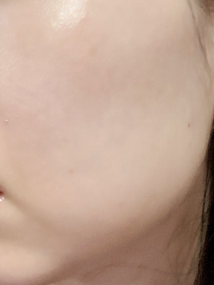 イハダ 薬用クリアバーム/IHADA/フェイスバームを使ったクチコミ(2枚目)