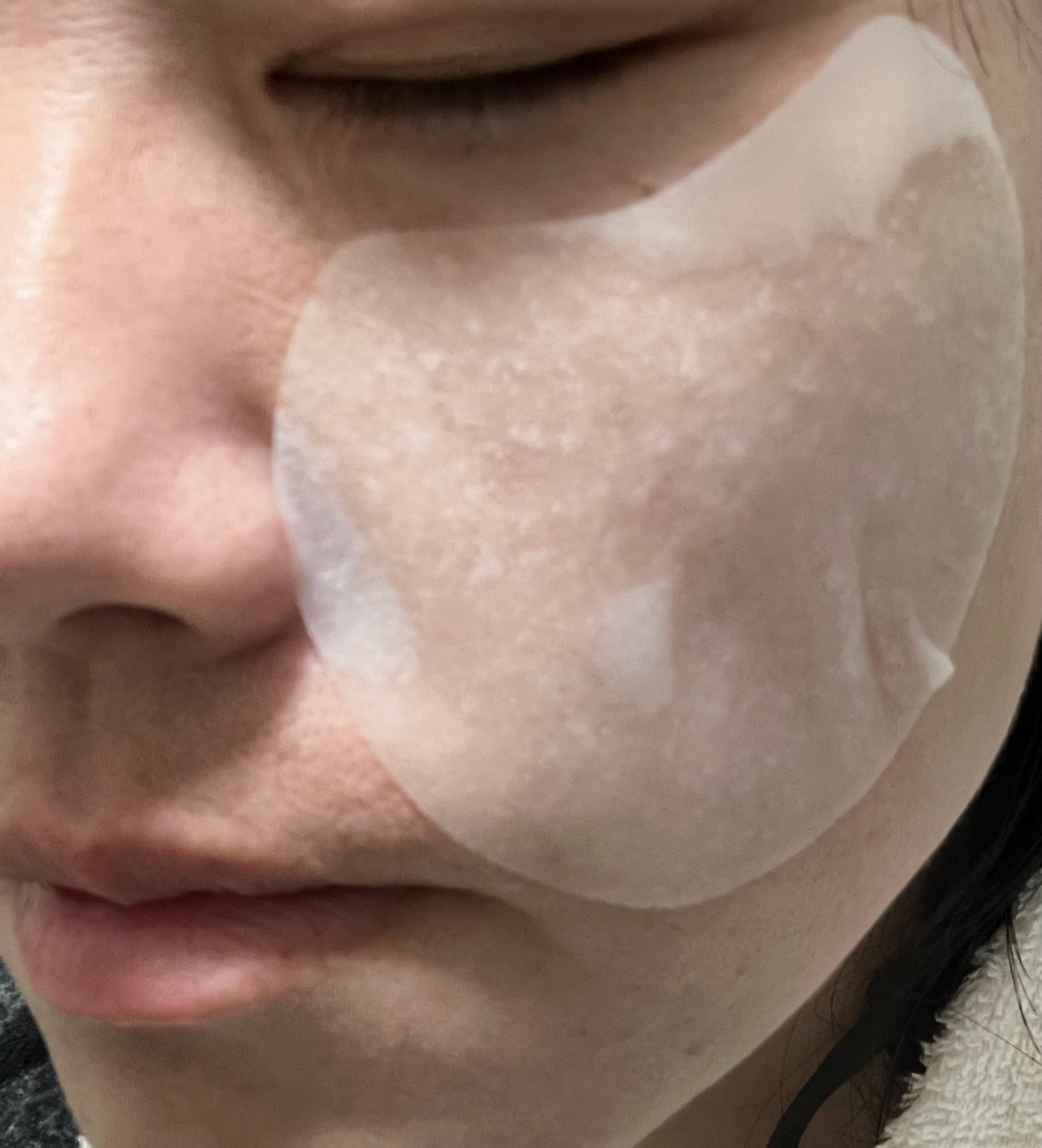 センテラ クイックカーミングパッド/SKIN1004/トナーパッドを使ったクチコミ（1枚目）