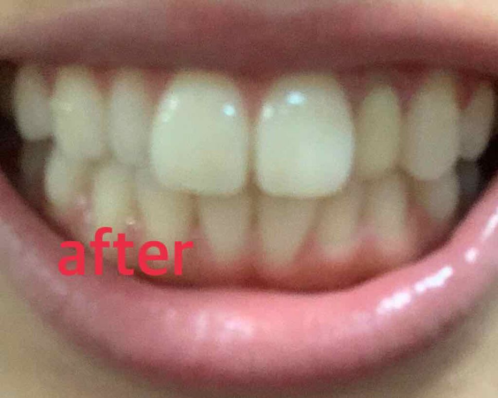 オーラツー プレミアム クレンジングフロス/オーラツー/デンタルフロス・歯間ブラシを使ったクチコミ（3枚目）