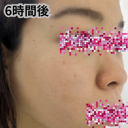 d プログラム アレルバリア クリームのクチコミ「程よく全体と毛穴をカバーしてくれる
艶が出る
そしてしっかりとしたテクスチャー
保湿されてる感.....」(2枚目)