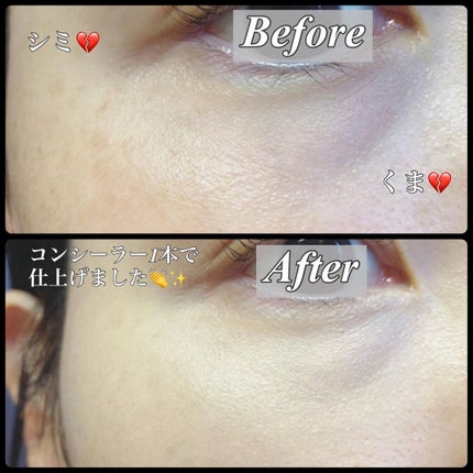 アディクション スキンリフレクト フィックス コンシーラー/ADDICTION/リキッドコンシーラーを使ったクチコミ(6枚目)
