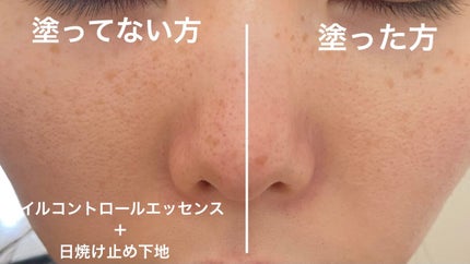 オイルコントロールカプセルエッセンス/celimax/美容液を使ったクチコミ(5枚目)