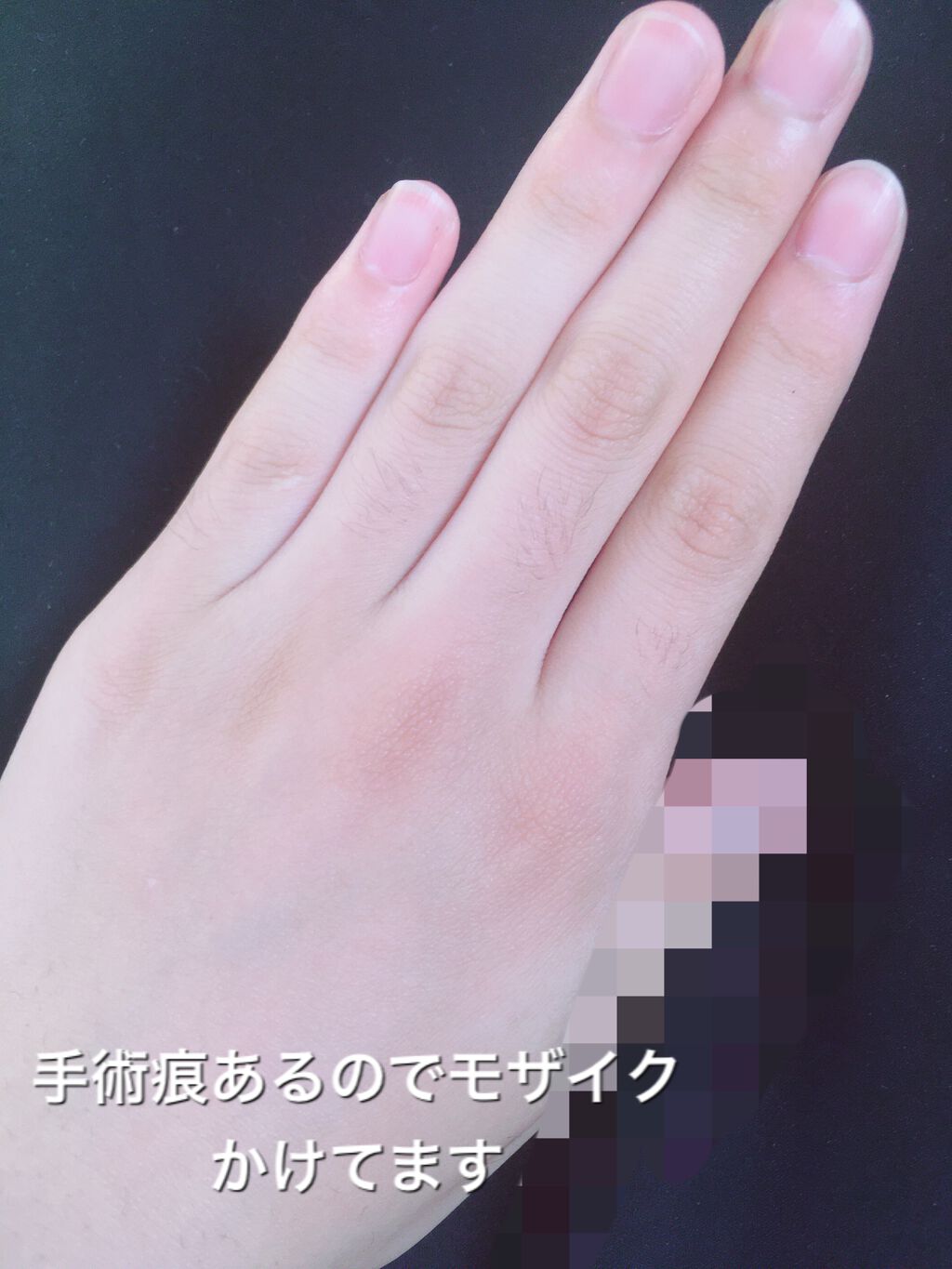 ニベアクリーム ニベアを使った口コミ 手を綺麗にする方法ご紹介しちゃいます By ねぎぴゅーたー 普通肌 10代後半 Lips ニベアクリーム ニベアを使った口コミ 手を綺麗にする方法ご紹介しちゃいます By ねぎぴゅーたー 普通肌 10代後半 Lips