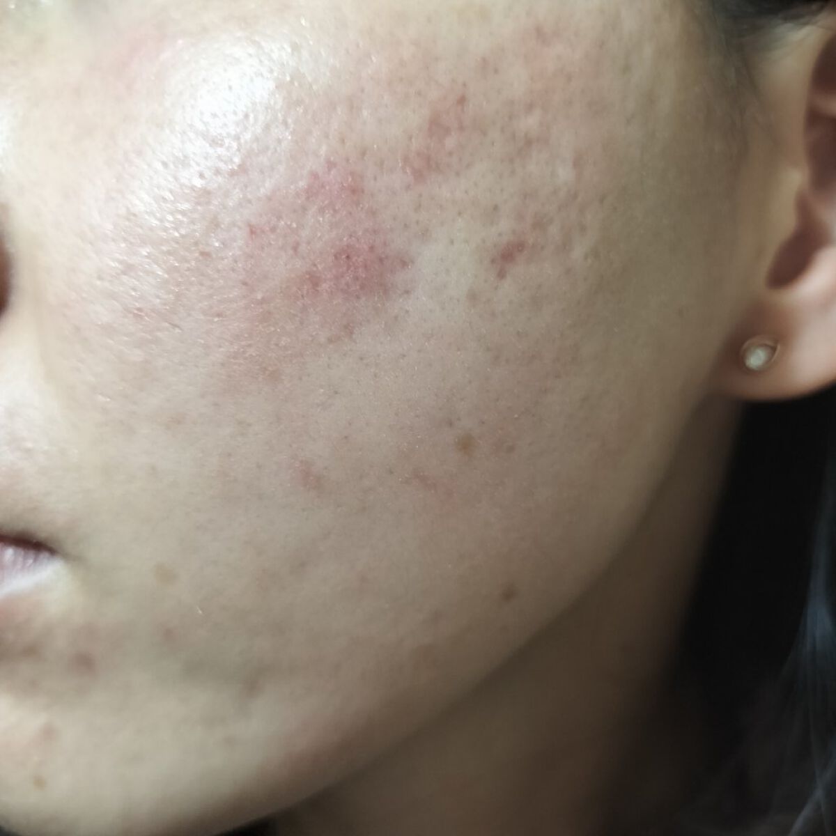 ビオオイル アルガンオイル/Melvita/フェイスオイルを使ったクチコミ（2枚目）