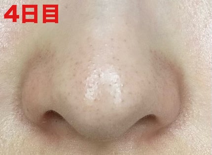 3番 緑茶炭毛穴パッククレンジングバーム/numbuzin/クレンジングバームを使ったクチコミ(6枚目)