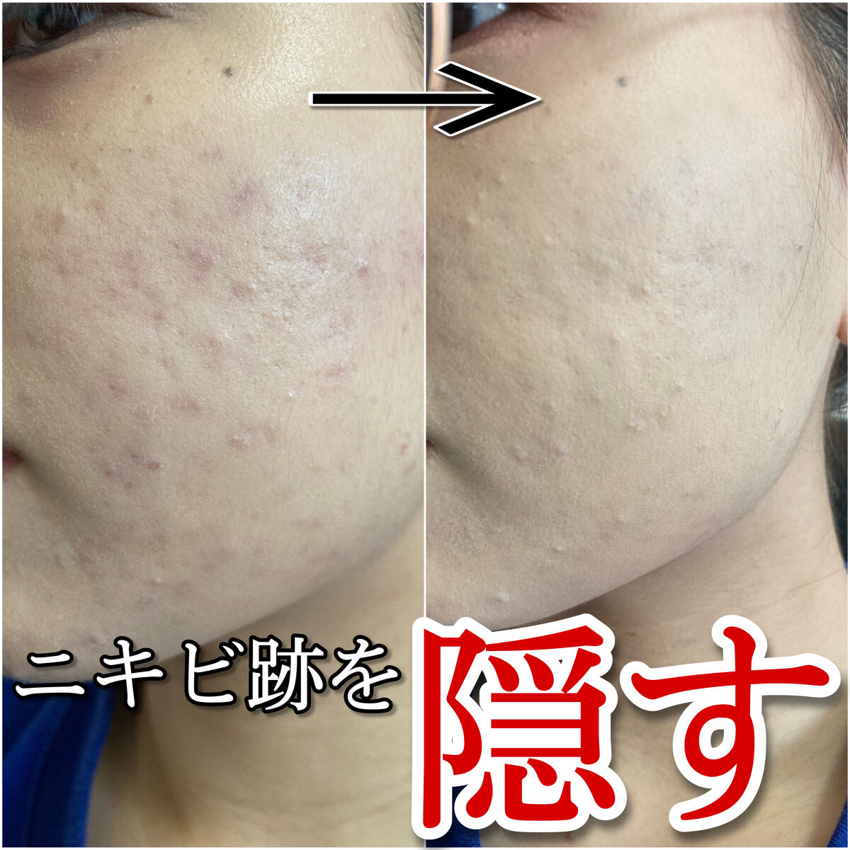 カバーパーフェクション チップコンシーラー/the SAEM/リキッドコンシーラーを使ったクチコミ（1枚目）