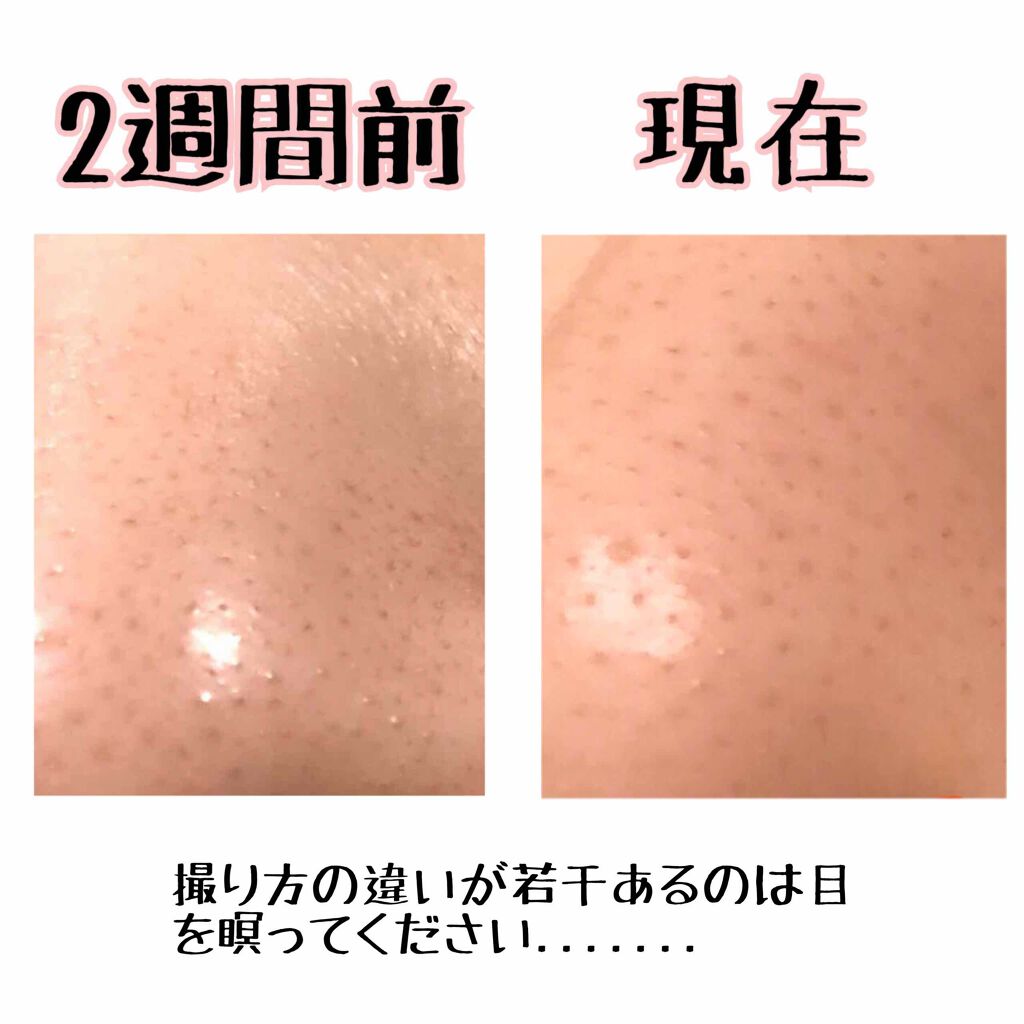 ホホバオイル/無印良品/ボディオイルを使ったクチコミ(3枚目)