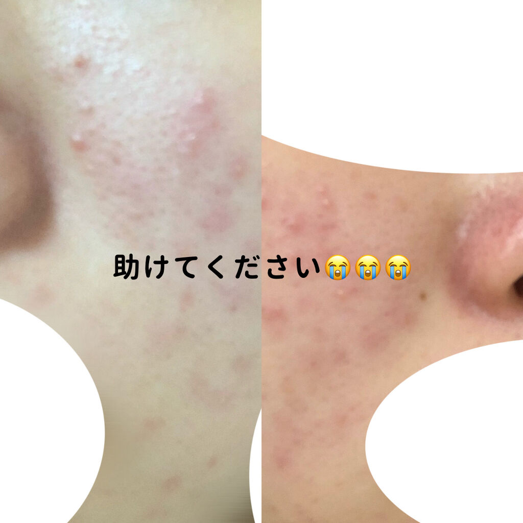 艶肌ドロップ/ラッシュ/美容液を使ったクチコミ（1枚目）