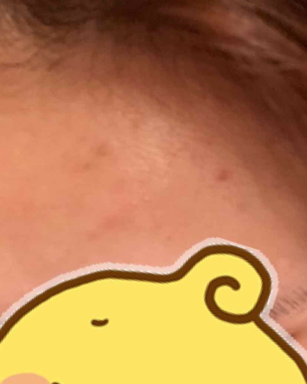 ペアアクネクリームW(医薬品)/ペア/その他を使ったクチコミ（3枚目）