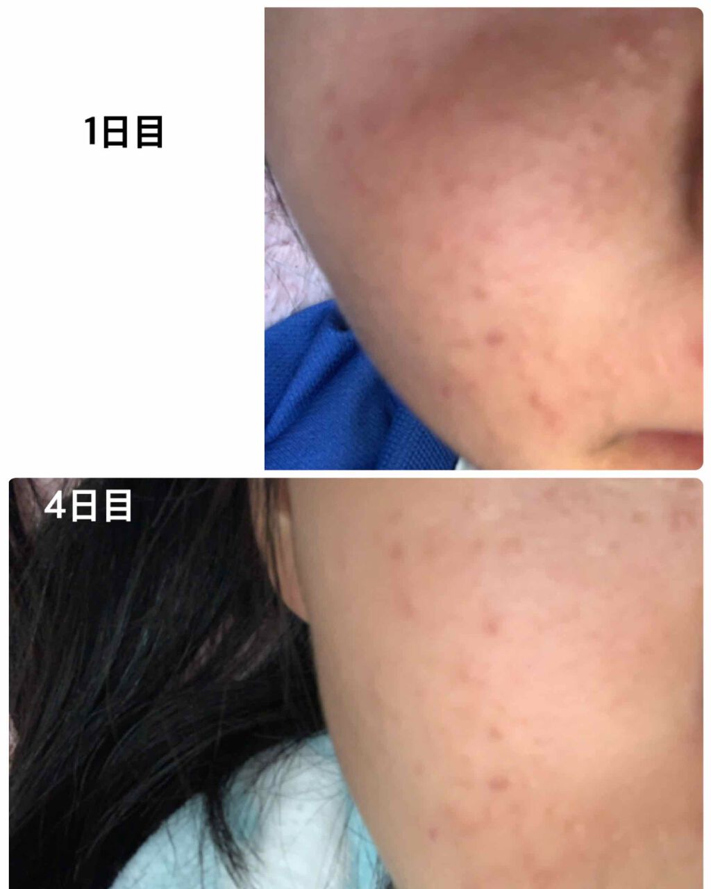 を使ったクチコミ（2枚目）