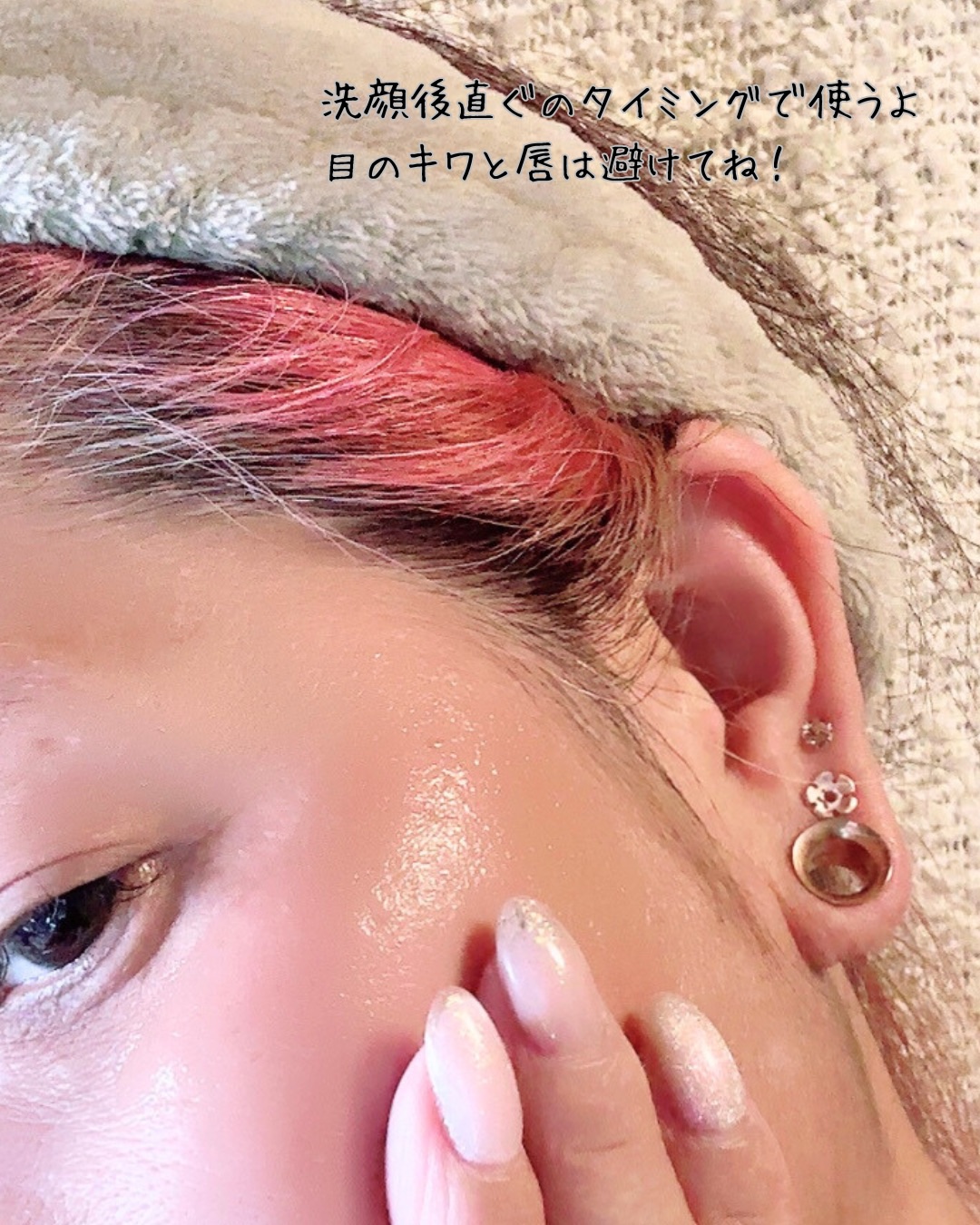 メディリフト ニードルリフトピールセラム/YA-MAN TOKYO JAPAN/美容液を使ったクチコミ（3枚目）