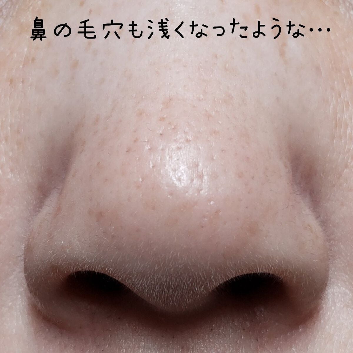 アンドハニー クレンジングバーム クリア/&honey/クレンジングバームを使ったクチコミ(5枚目)