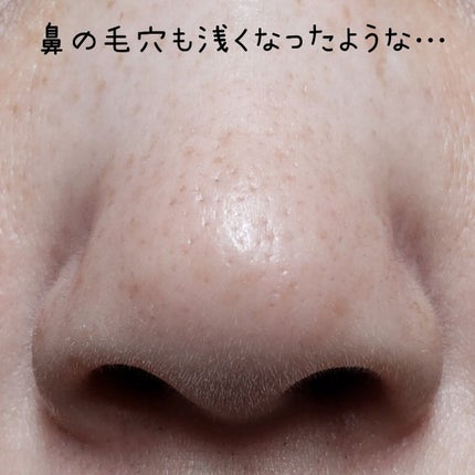 アンドハニー クレンジングバーム クリア/&honey/クレンジングバームを使ったクチコミ(5枚目)