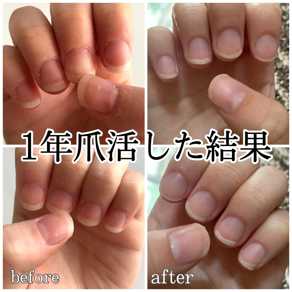 ハンドベール プレミアムリッチネイル/メンソレータム/ネイルオイル・トリートメントを使ったクチコミ（1枚目）