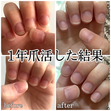 ハンドベール プレミアムリッチネイル/メンソレータム/ネイルオイル・トリートメントを使ったクチコミ(1枚目)