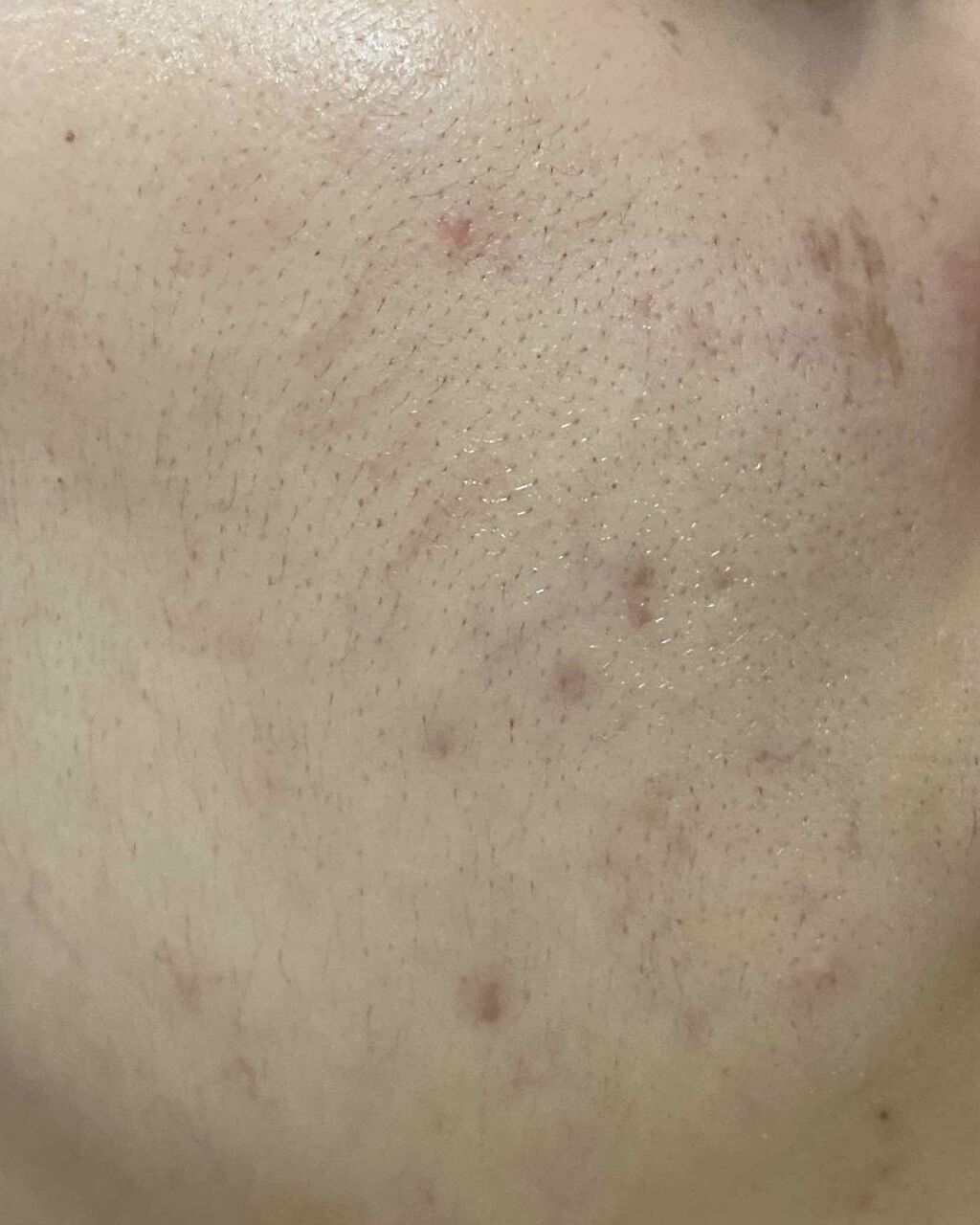 敏感肌用薬用美白美容液/無印良品/美容液を使ったクチコミ(2枚目)