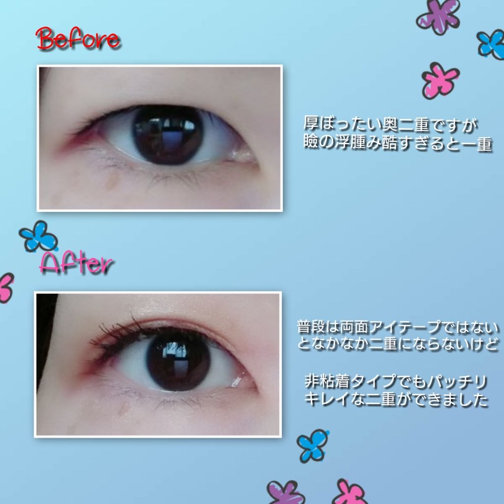 【旧品】オリシキ アイリッドスキンフィルム/D-UP/二重まぶた用アイテムを使ったクチコミ（2枚目）