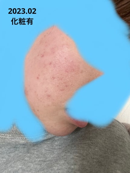 を使ったクチコミ(1枚目)