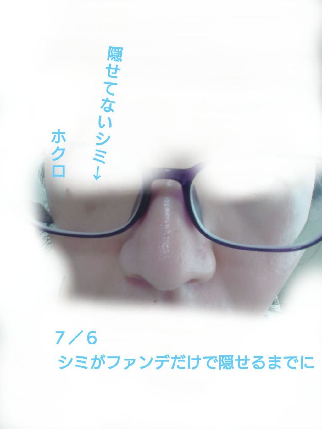 リンクルホワイトエッセンス/オルビス/美容液を使ったクチコミ(2枚目)