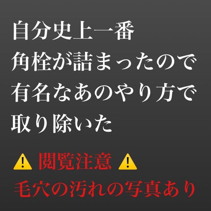 ソフティモ 角栓すっきり黒パック/ソフティモ/シートマスク・パックを使ったクチコミ(1枚目)