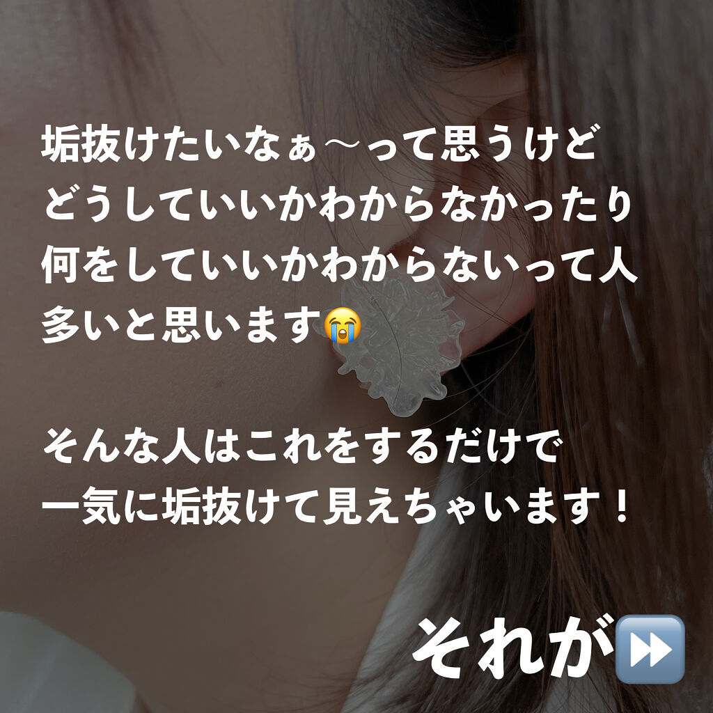 脱色クリーム 敏感肌用/エピラット/ムダ毛ケアを使ったクチコミ（2枚目）