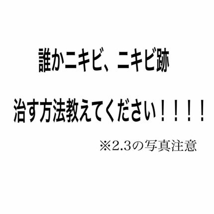 敏感肌用薬用美白美容液/無印良品/美容液を使ったクチコミ(1枚目)