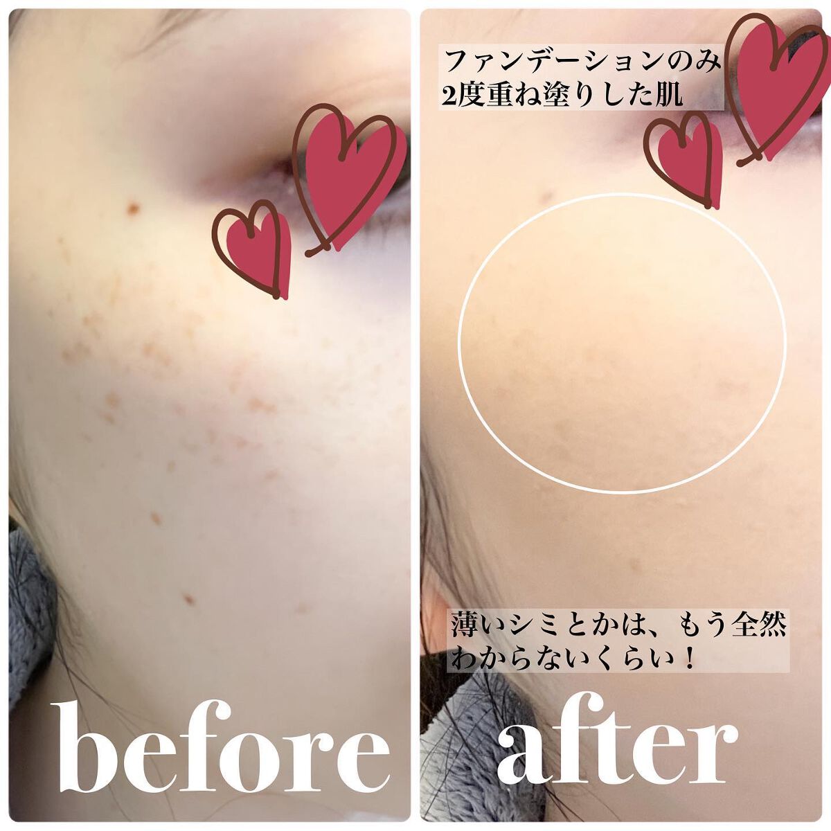 chichannnnð§žãã©ãã100 on LIPS ãâïžã¢ã³ãžãšã³ããã¹ããŒãžããŠããŒã«ã€ããŠã¬ãã¥ãŒããŸãðð€ïŒŒ..ãïŒ4æç®ïŒ