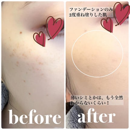 chichannnnð§žãã©ãã100 on LIPS ãâïžã¢ã³ãžãšã³ããã¹ããŒãžããŠããŒã«ã€ããŠã¬ãã¥ãŒããŸãðð€ïŒŒ..ãïŒ4æç®ïŒ