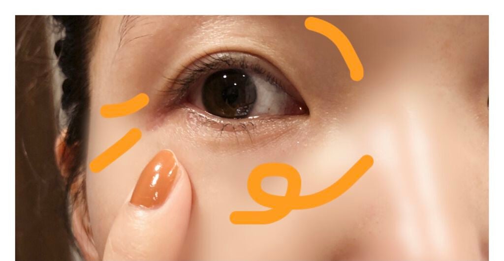 リンクルショット メディカル セラム N/リンクルショット/アイケア・アイクリームを使ったクチコミ(5枚目)