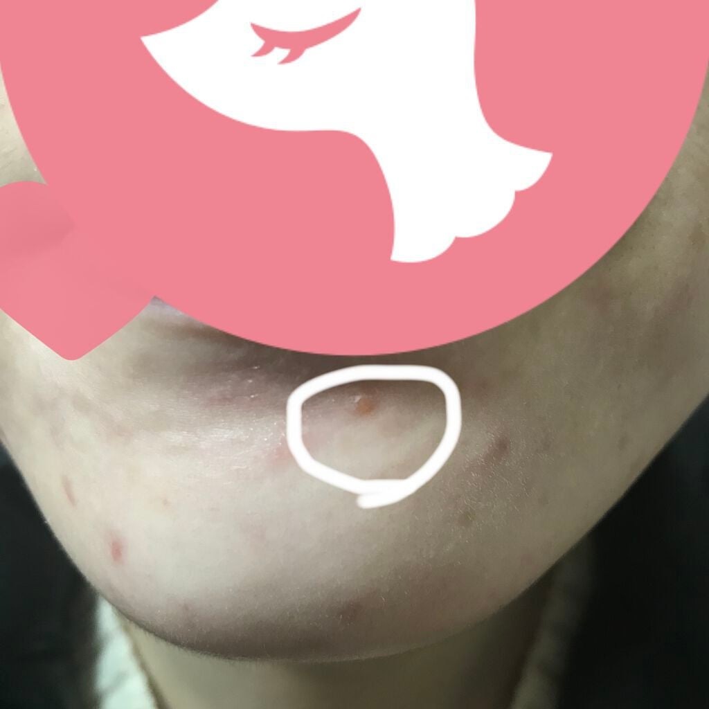 N10+Z1フェイスセラム /The Ordinary/美容液を使ったクチコミ(3枚目)