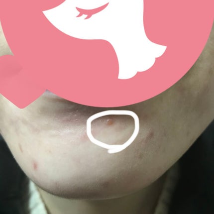 N10+Z1フェイスセラム /The Ordinary/美容液を使ったクチコミ(3枚目)