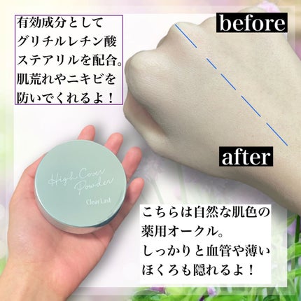 クリアラスト フェイスパウダー N 薬用オークル/クリアラスト/プレストパウダーを使ったクチコミ(5枚目)
