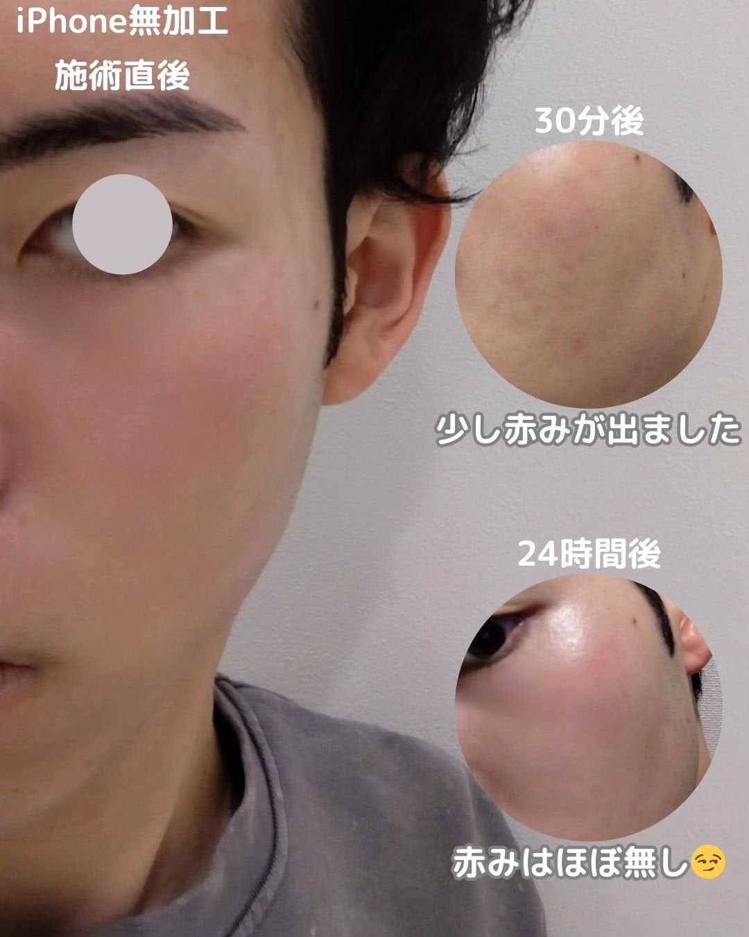 あき┃筋トレ美容家 on LIPS 「👈"垢抜け偏差値"をアップしたい方はフォロー初めてのハイドラフ..」(3枚目)