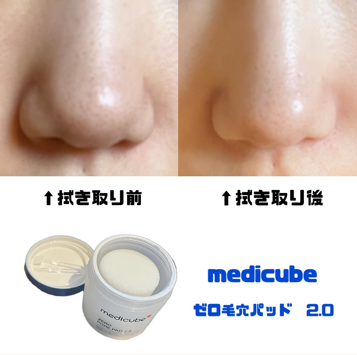 ゼロ毛穴パッド 2.0/MEDICUBE/トナーパッドを使ったクチコミ（1枚目）