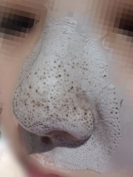 ツルリ 皮脂吸い出し 部分用パック ガスール&レッドパワー/ツルリ/洗い流すパック・マスクを使ったクチコミ(2枚目)