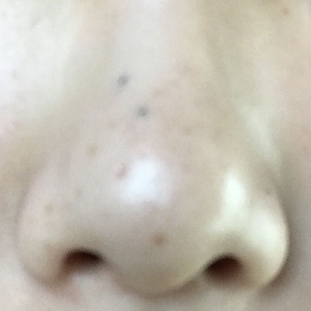 デュオ ザ クレンジングバーム クリア/DUO/クレンジングバームを使ったクチコミ（2枚目）