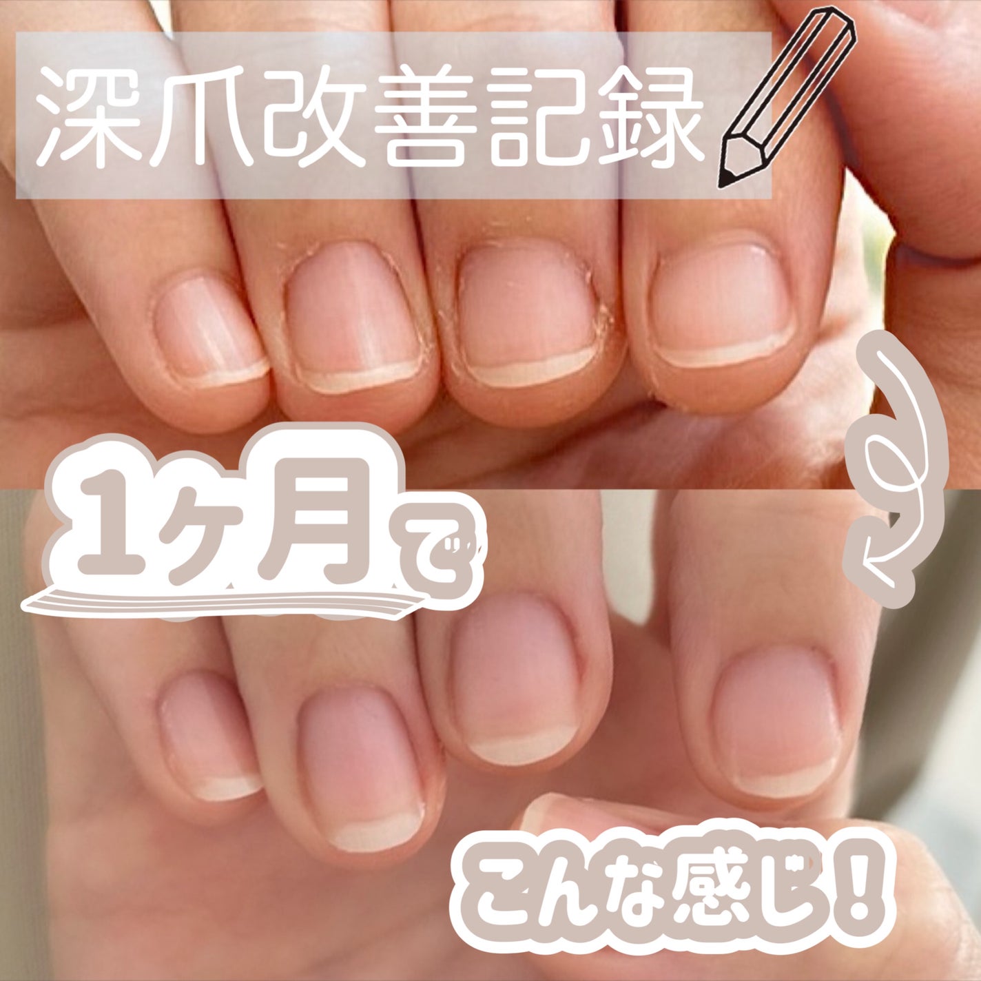 甘皮ケアオイル/無印良品/ネイルオイル・トリートメントを使ったクチコミ(1枚目)