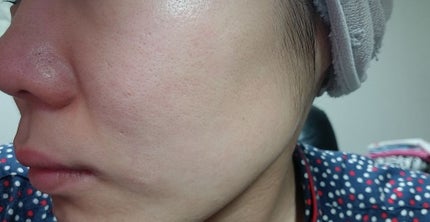 黒真珠マスク/我的美麗日記/シートマスク・パックを使ったクチコミ(4枚目)