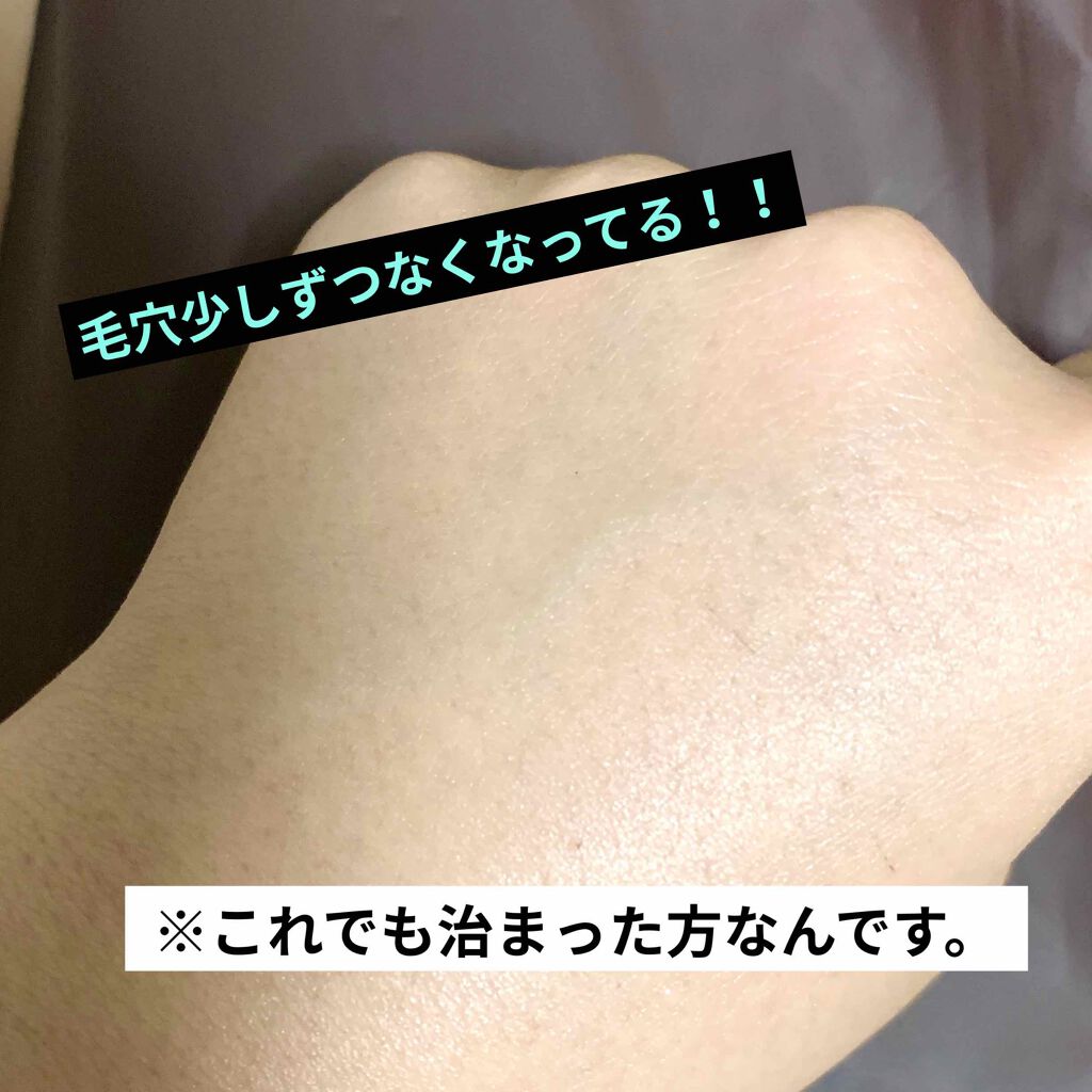 ニベアクリーム/ニベア/ボディクリームを使ったクチコミ(1枚目)