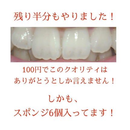 ホワイトニングスポンジ/キャンドゥ/その他オーラルケアを使ったクチコミ(6枚目)