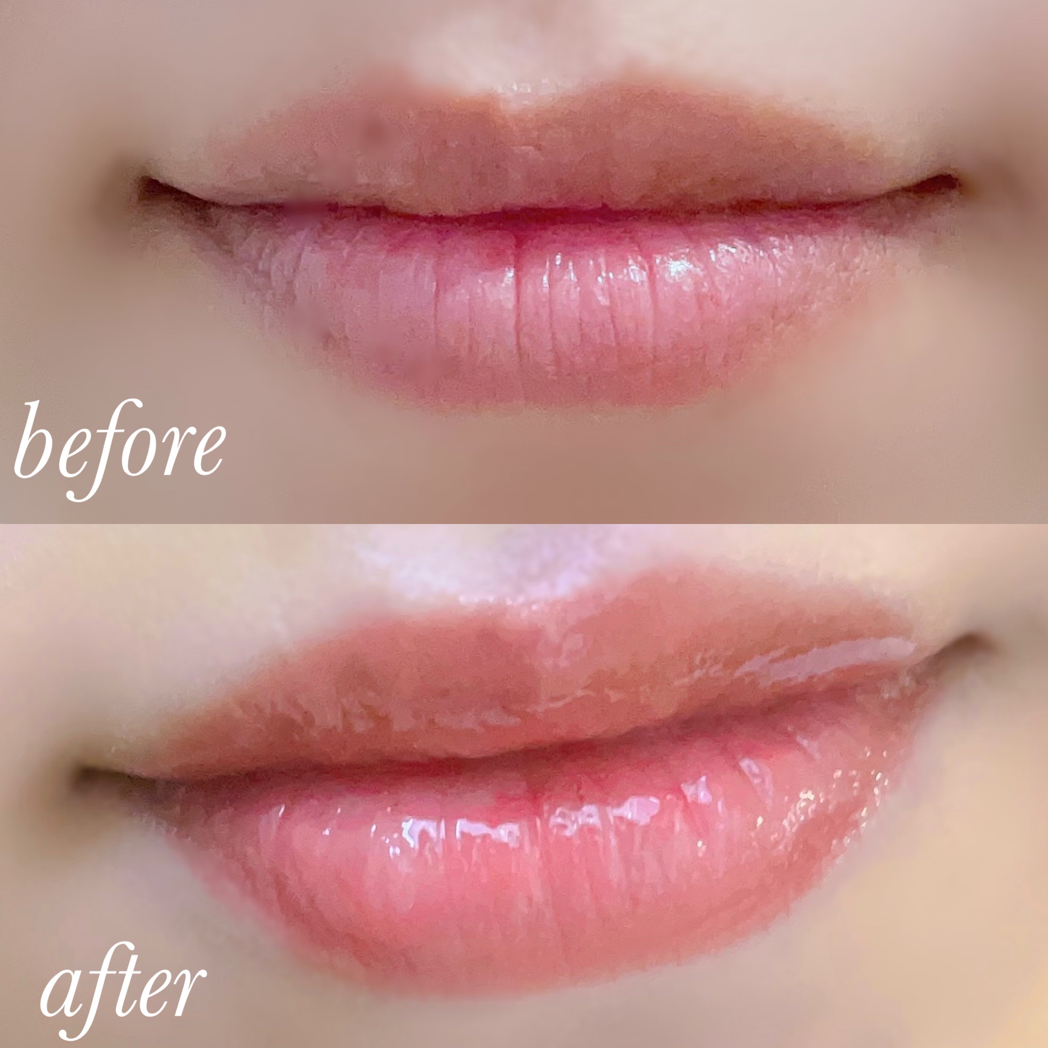 ドトムリッププラスプランパー 03 スプリングダーリン(SPRING DARLING)/keybo/リッププランパーを使ったクチコミ（2枚目）