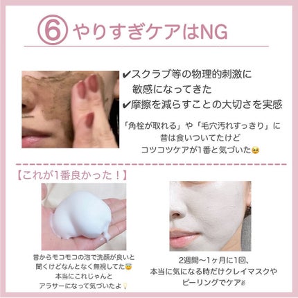 レンジでゆたぽん首・肩用/レンジでゆたぽん/ボディグッズを使ったクチコミ(7枚目)