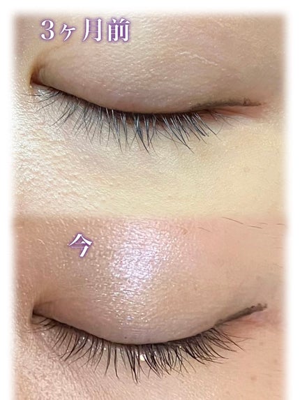 スカルプD ボーテ ピュアフリーアイラッシュセラム/アンファー(スカルプD)/まつげ美容液を使ったクチコミ(2枚目)