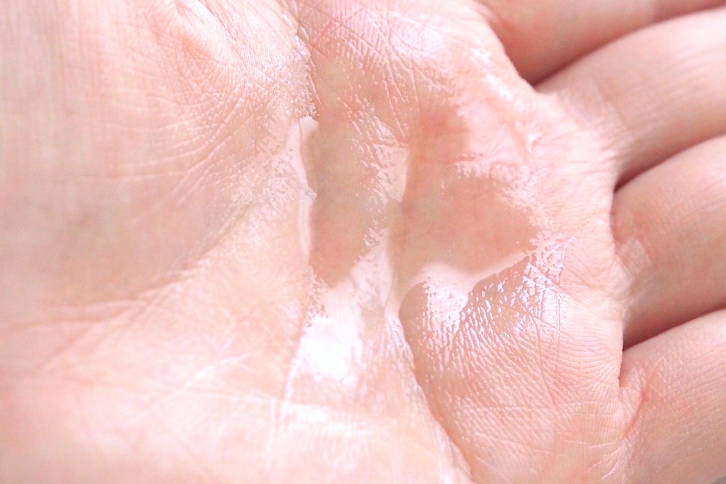 イドラクラリティ 薬用 トリートメント エッセンス ウォーター/DECORTÉ/化粧水を使ったクチコミ(6枚目)