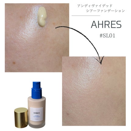 ã¢ã³ãã£ãŽã¡ã€ããã ã·ã¢ãŒãã¡ã³ããŒã·ã§ã³/ã¢ãŒã¬ã¹/ãªããããã¡ã³ããŒã·ã§ã³ã䜿ã£ãã¯ãã³ãïŒ2æç®ïŒ